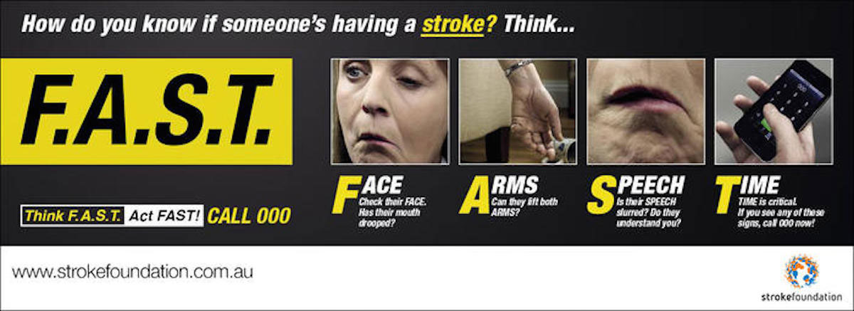 How-to-know-when-someone-is-having-a-stroke